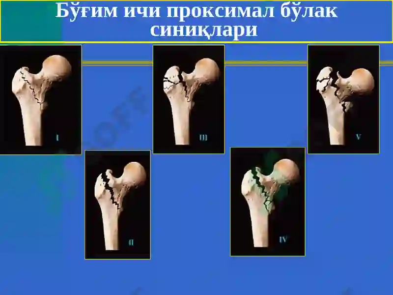 Preview 6